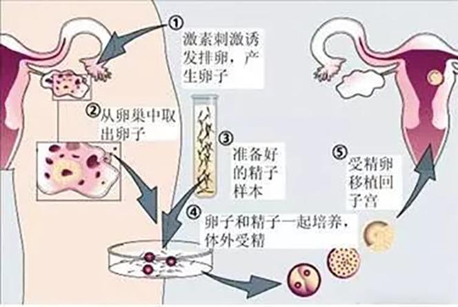 试管供卵代孕有吗